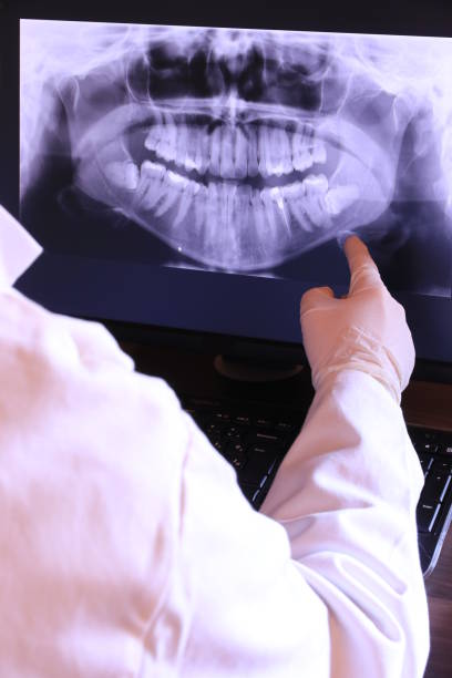 Best Dental Abscess Treatment in Kingston, WA