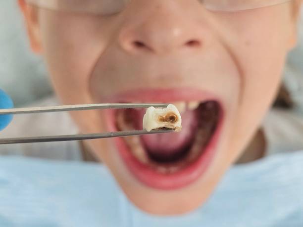 Best Walk-In Emergency Dental Services in Kingston, WA