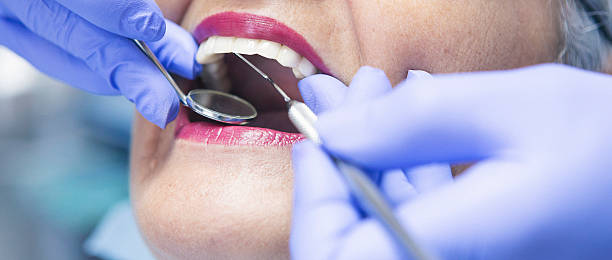 Best Emergency Care for Gum Disease in Kingston, WA
